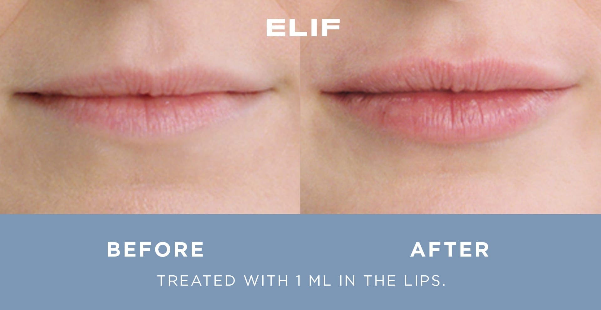 Side by side comparison of woman's lips